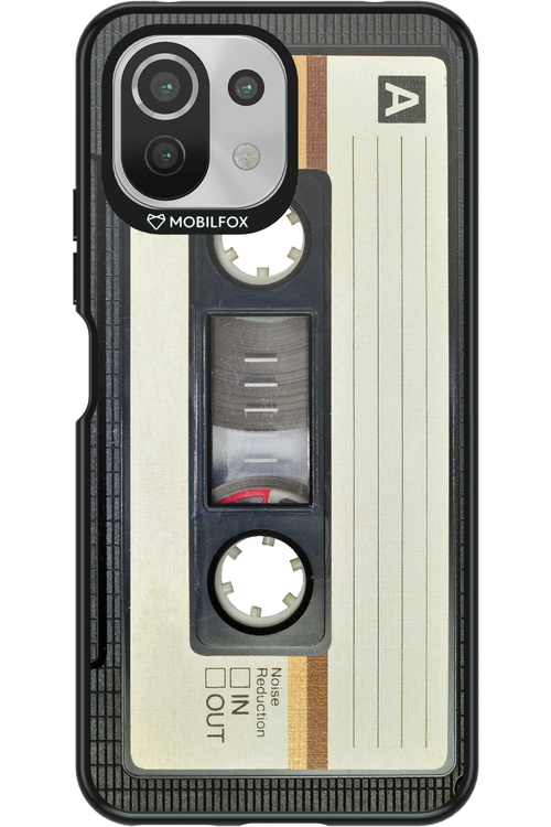 CASE 11 - Xiaomi Mi 11 Lite (2021)