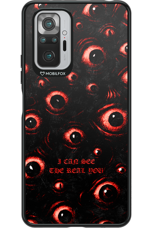 The Watchers - Xiaomi Redmi Note 10S