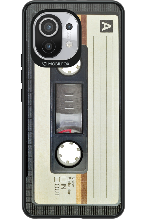 CASE 11 2.0 - Xiaomi Mi 11 5G
