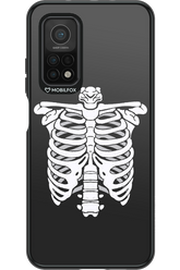 SKELETON - Xiaomi Mi 10T 5G