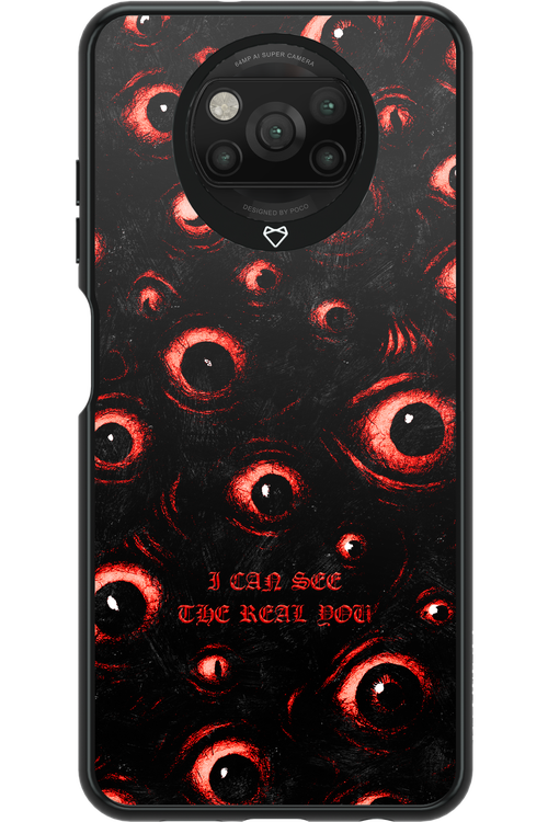 The Watchers - Xiaomi Poco X3 Pro