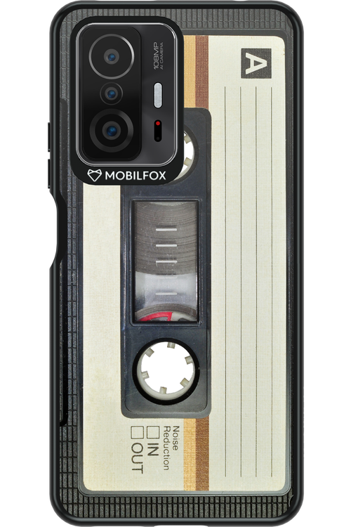 CASE 11 - Xiaomi Mi 11T