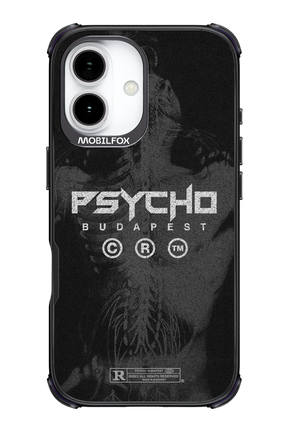 X-Ray - Apple iPhone 17