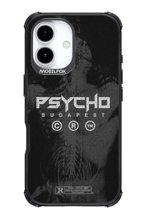 X-Ray - Apple iPhone 17