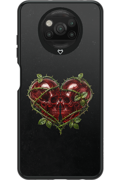 Omen Kiss 2.0 - Xiaomi Poco X3 NFC