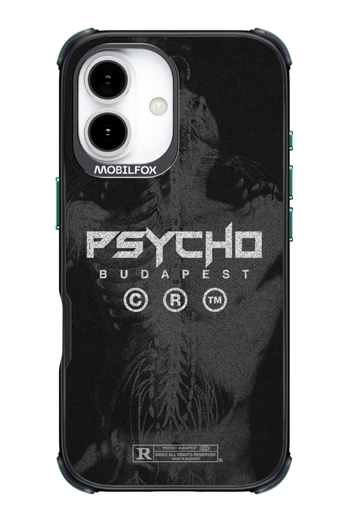 X-Ray - Apple iPhone 17