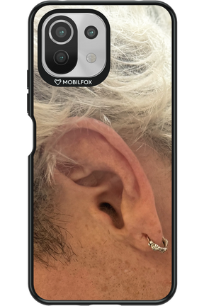 Ear 2.0 - Xiaomi Mi 11 Lite (2021)