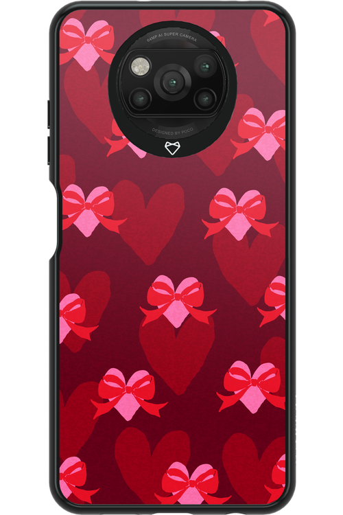 My Heart My Love - Xiaomi Poco X3 Pro