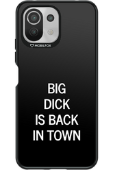 Big D*ck Black 2.0 - Xiaomi Mi 11 Lite (2021)