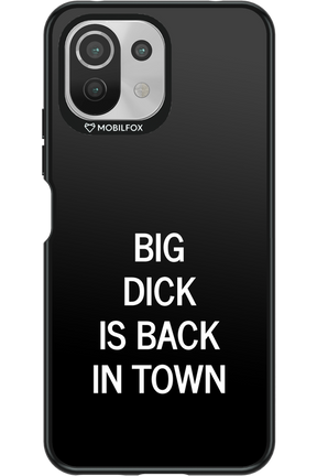 Big D*ck Black 2.0 - Xiaomi Mi 11 Lite (2021)