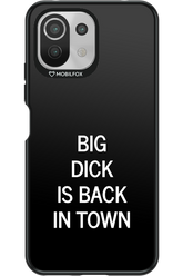 Big D*ck Black - Xiaomi Mi 11 Lite (2021)
