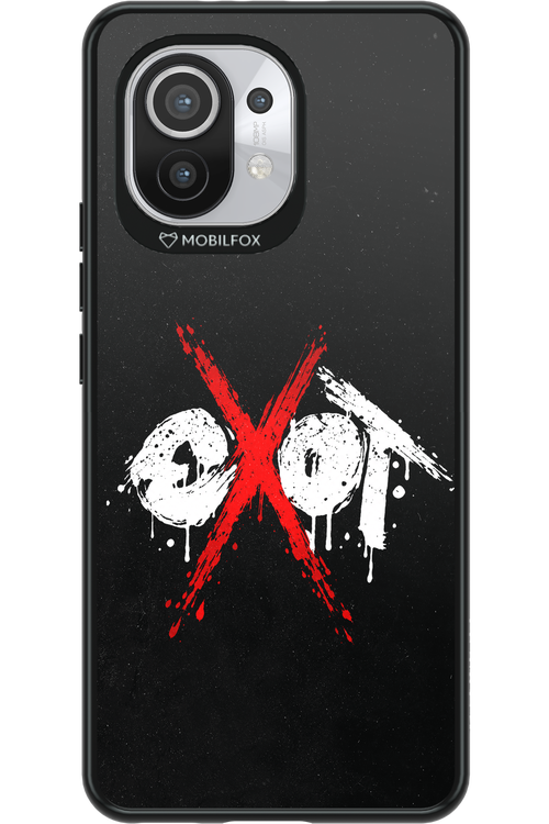 EXOT BLACK 2.0 - Xiaomi Mi 11 5G