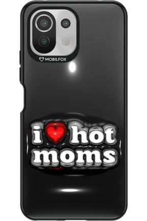 I love hot moms puffer - Xiaomi Mi 11 Lite (2021)