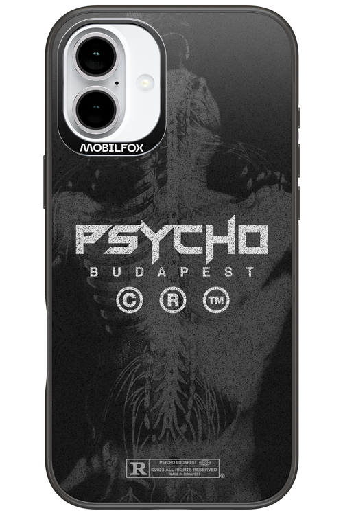 X-Ray - Apple iPhone 16 Plus