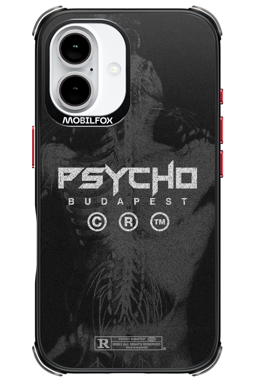 X-Ray - Apple iPhone 16