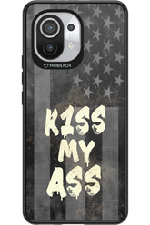 KISS II 2.0 - Xiaomi Mi 11 5G