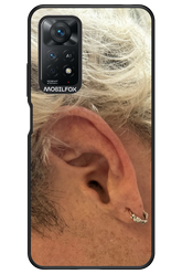 Ear 2.0 - Xiaomi Redmi Note 11Pro 4G/5G