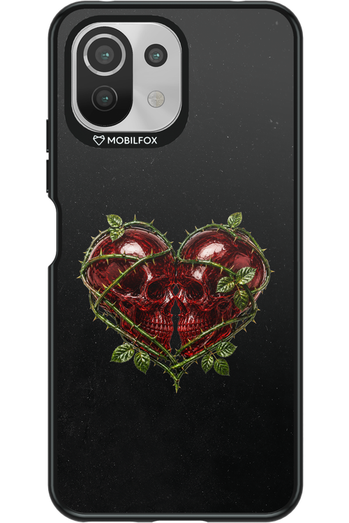 Omen Kiss 2.0 - Xiaomi Mi 11 Lite (2021)