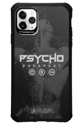 X-Ray - Apple iPhone 11 Pro Max