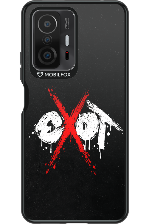 EXOT BLACK 2.0 - Xiaomi Mi 11T