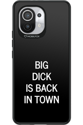 Big D*ck Black - Xiaomi Mi 11 5G