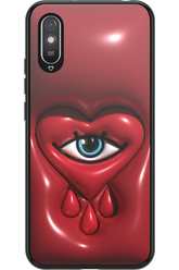 Heart Eye - Xiaomi Redmi 9A