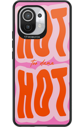 Too Damn Hot - Xiaomi Mi 11 5G