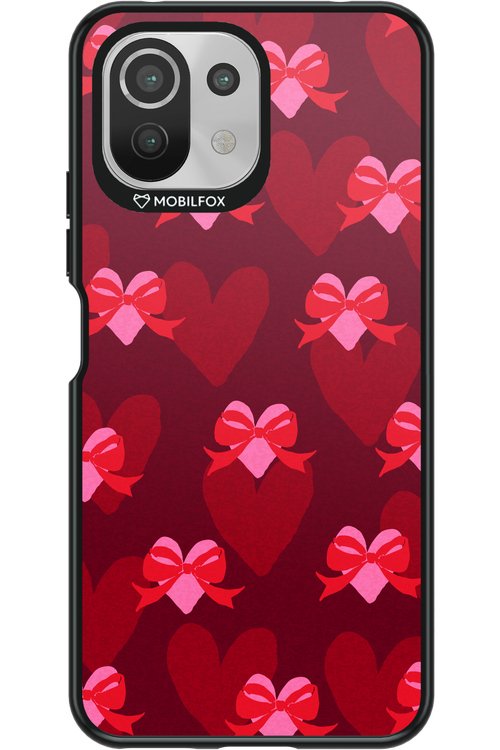 My Heart My Love - Xiaomi Mi 11 Lite (2021)