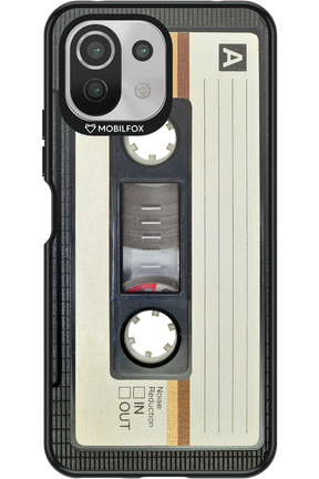 CASE 11 - Xiaomi Mi 11 Lite (2021)