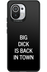 Big D*ck Black 2.0 - Xiaomi Mi 11 5G