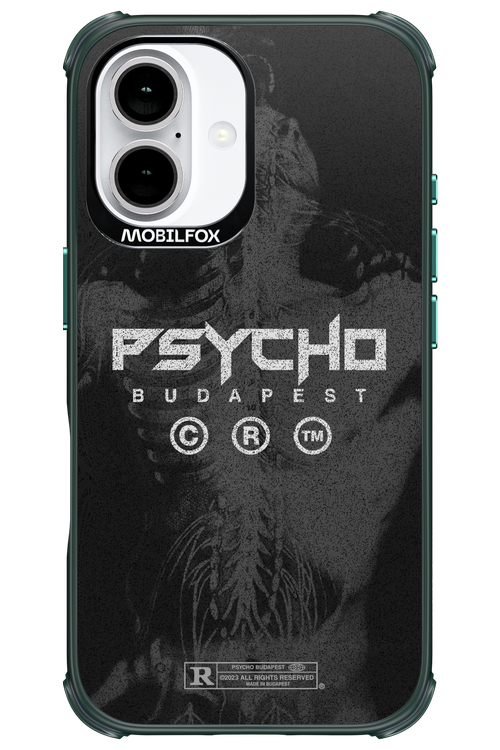 X-Ray - Apple iPhone 16