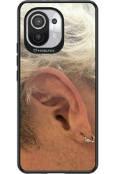 Ear 2.0 - Xiaomi Mi 11 5G