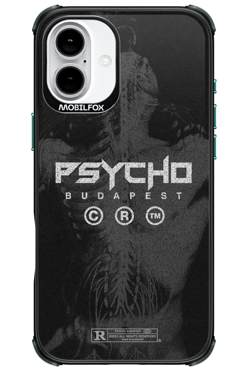 X-Ray - Apple iPhone 16 Plus