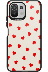 Sprinkle Heart - Xiaomi Mi 11 Lite (2021)