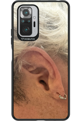 Ear 2.0 - Xiaomi Redmi Note 10S