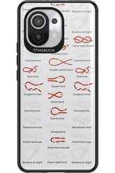 Knot Master 2.0 - Xiaomi Mi 11 5G