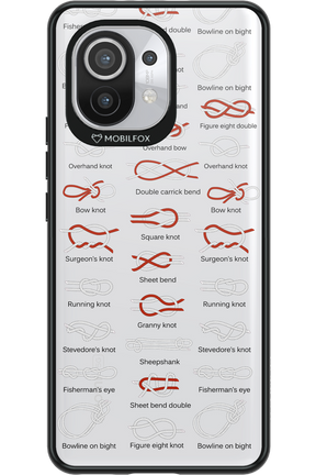 Knot Master 2.0 - Xiaomi Mi 11 5G
