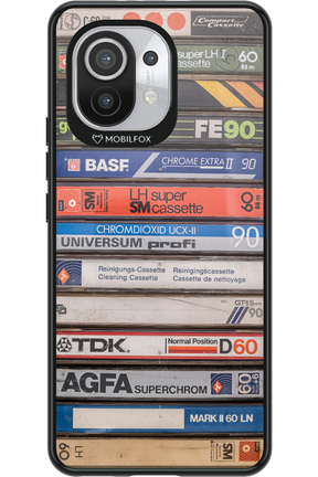 Retro Vibes - Xiaomi Mi 11 5G