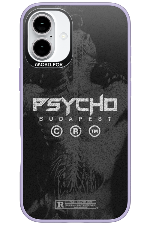 X-Ray - Apple iPhone 16 Plus