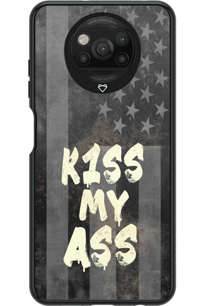 KISS II 2.0 - Xiaomi Poco X3 NFC