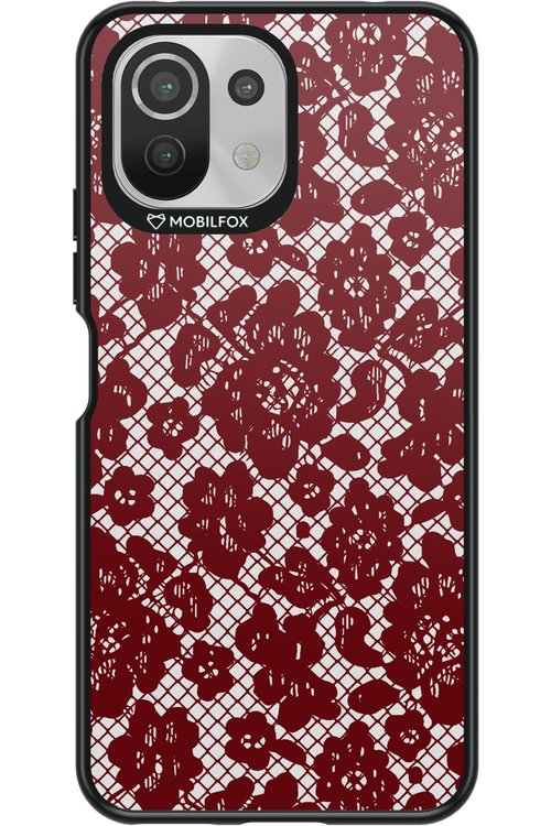 Lace Lover - Xiaomi Mi 11 Lite (2021)
