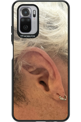Ear 2.0 - Xiaomi Redmi Note 10