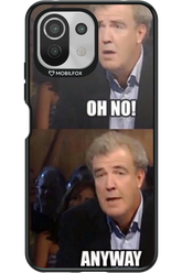 Clarkson Meme 2.0 - Xiaomi Mi 11 Lite (2021)