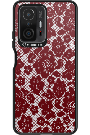 Lace Lover - Xiaomi Mi 11T Pro