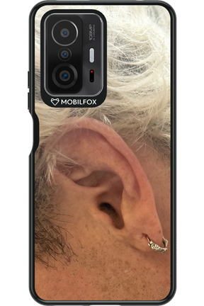 Ear 2.0 - Xiaomi Mi 11T