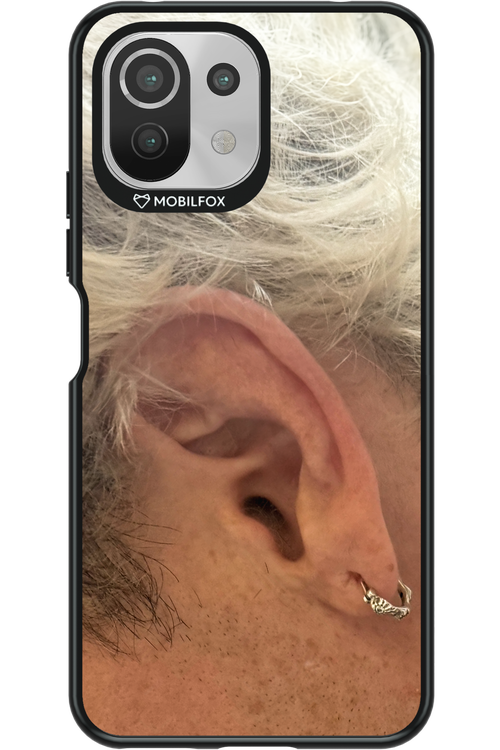 Ear 2.0 - Xiaomi Mi 11 Lite (2021)