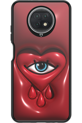 Heart Eye - Xiaomi Redmi Note 9T 5G