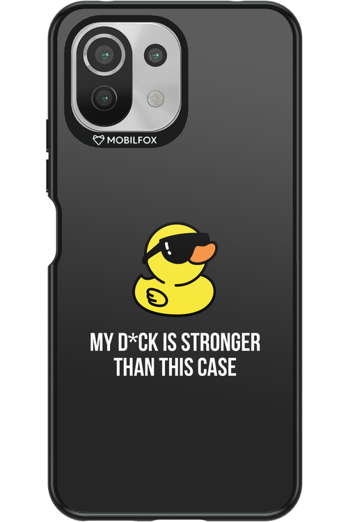 My D_ck 2.0 - Xiaomi Mi 11 Lite (2021)