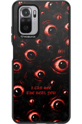 The Watchers - Xiaomi Redmi Note 10