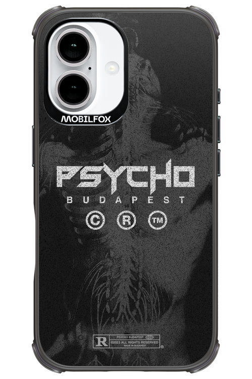X-Ray - Apple iPhone 16
